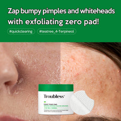 Troubless Clear Toner Pad tea tree formula supports oil-control
