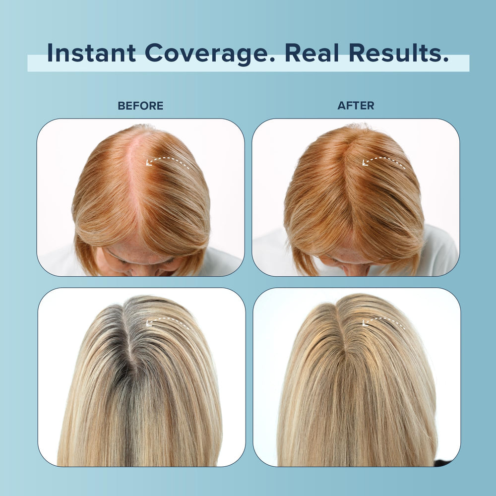 Truhair Natural hair-like finish blends with your look for a confident style