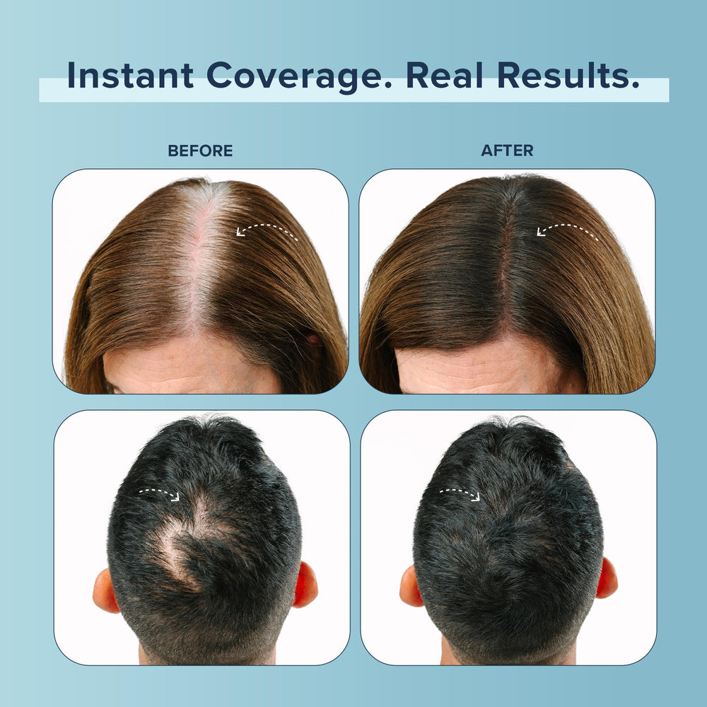 Truhair Rice starch absorbs oils, refreshing hair between washes