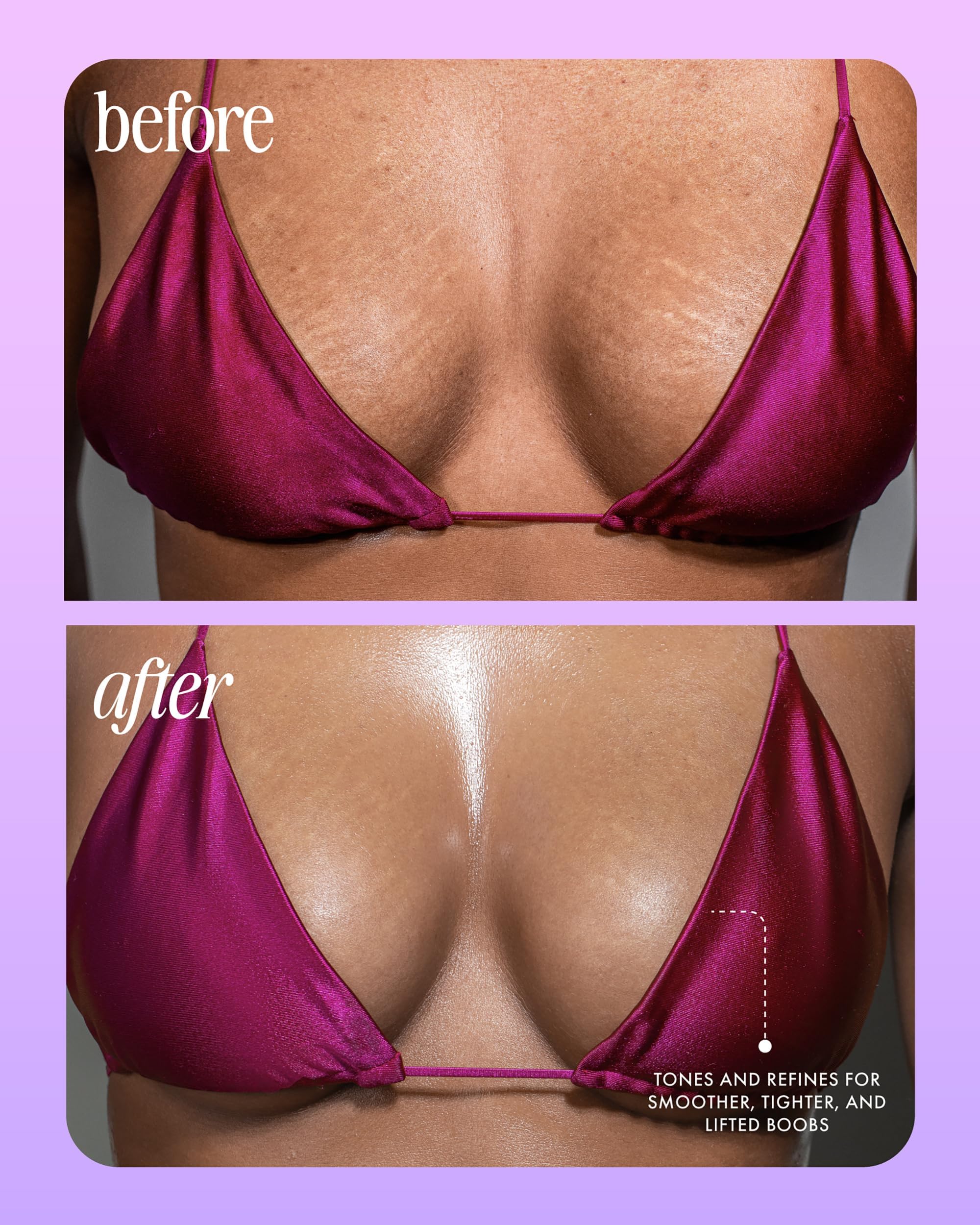 After application, chest shows subtle glow and smoother texture with Truly serum.