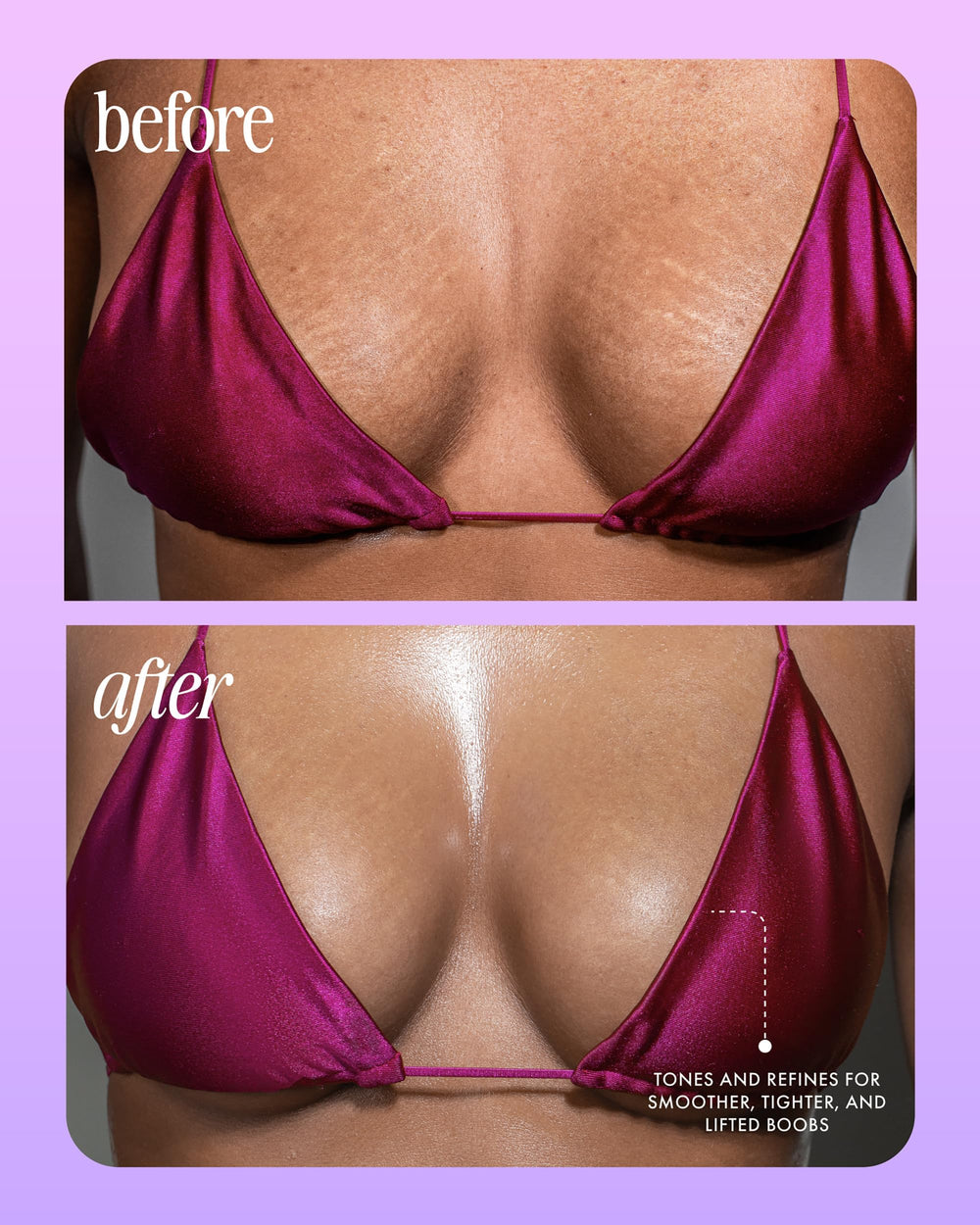 After application, chest shows subtle glow and smoother texture with Truly serum.