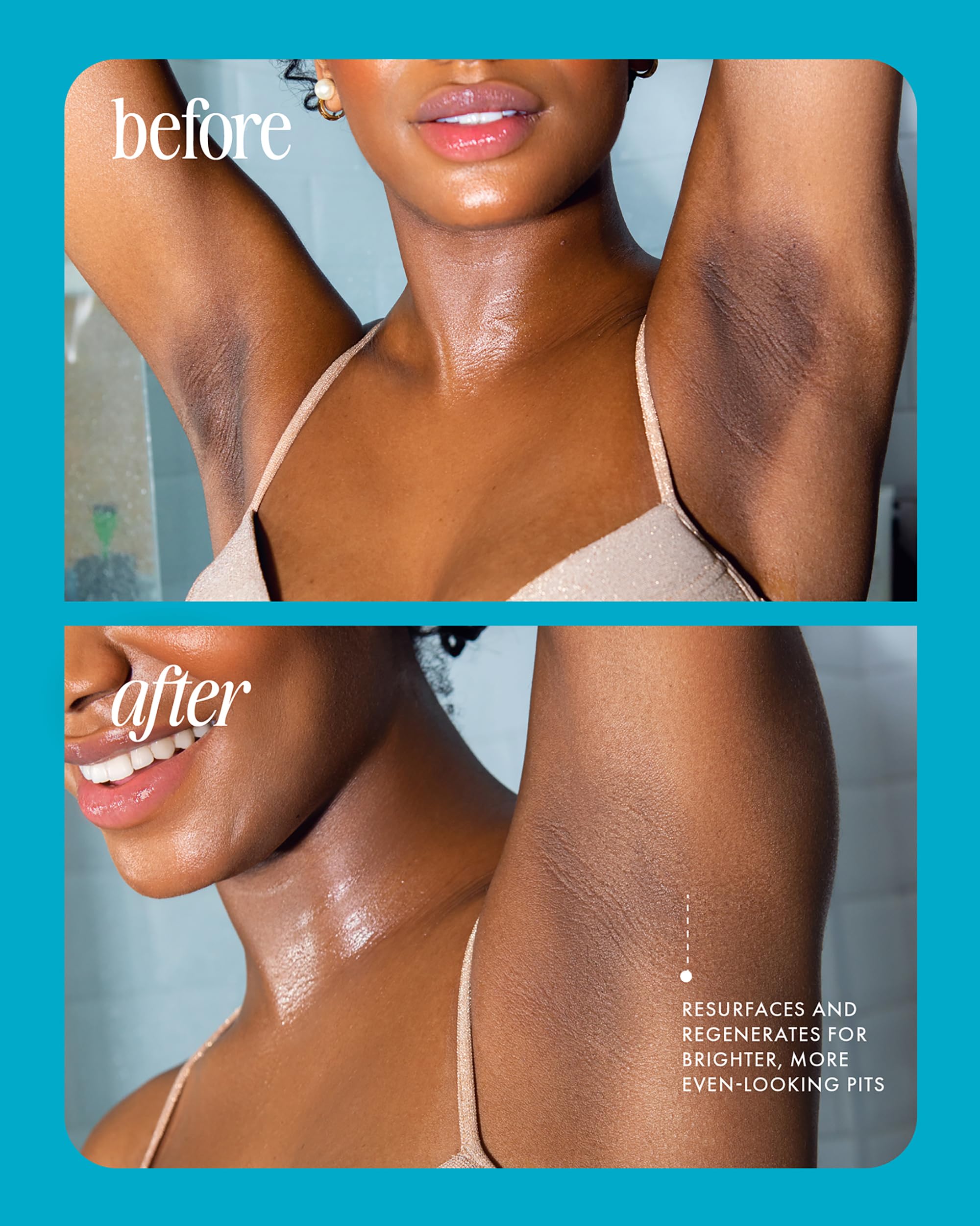 Truly Jelly Booster Pigment applying on treated area suggesting targeted care.