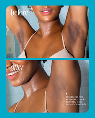 Truly Jelly Booster Pigment applying on treated area suggesting targeted care.