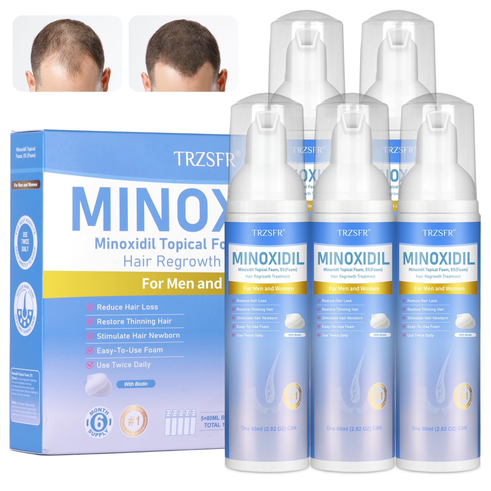 Trzsfr 5% Minoxidil Foam bottle application for even coverage on the scalp