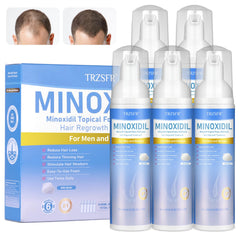 Trzsfr 5% Minoxidil Foam bottle application for even coverage on the scalp