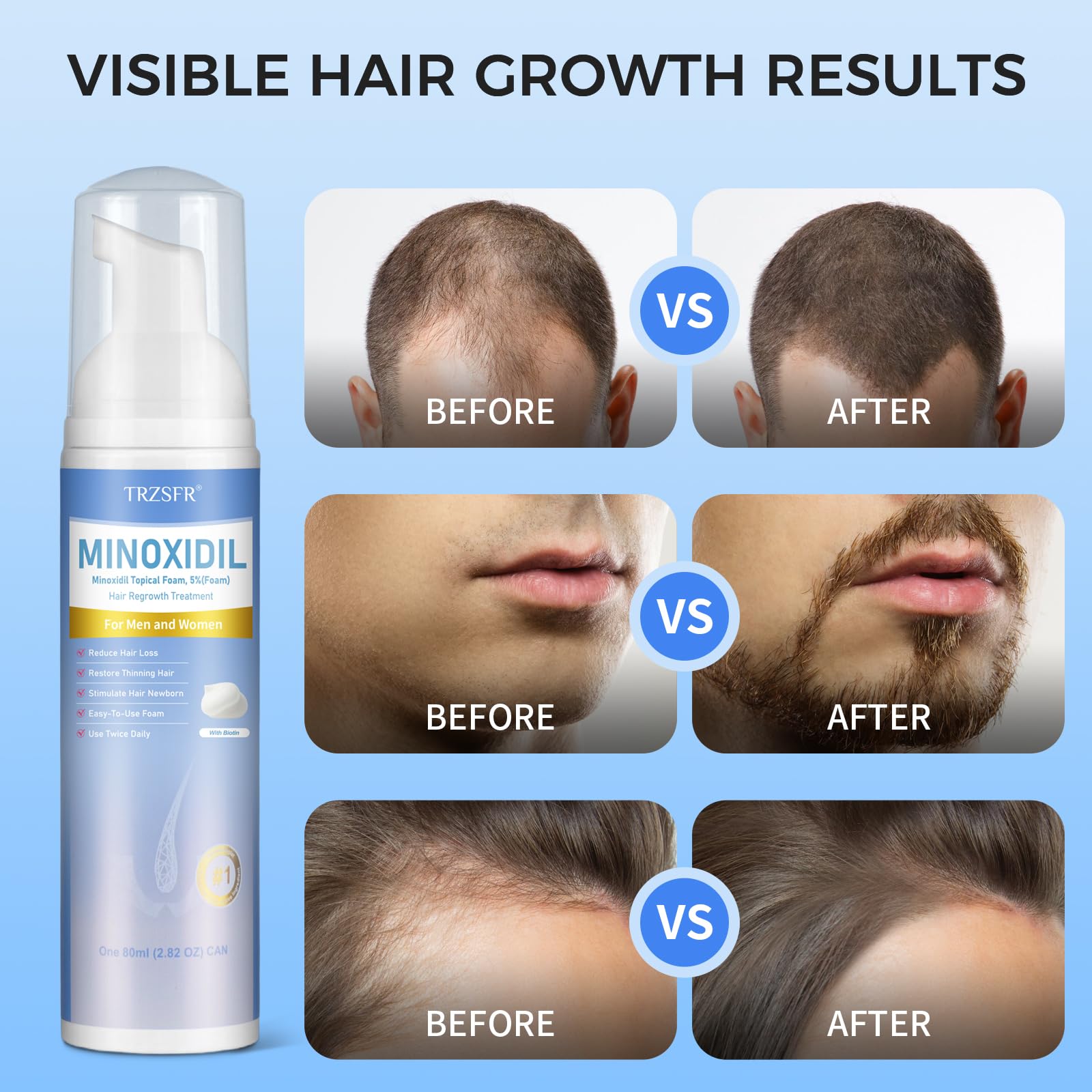Trzsfr hair-density visual highlights fuller-looking strands and healthier roots