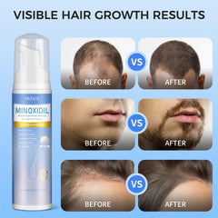 Trzsfr hair-density visual highlights fuller-looking strands and healthier roots