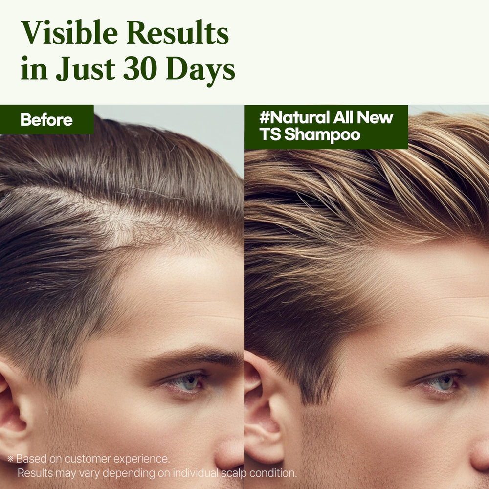 TS SHAMPOO clear gel texture delivers deep, balanced cleansing.