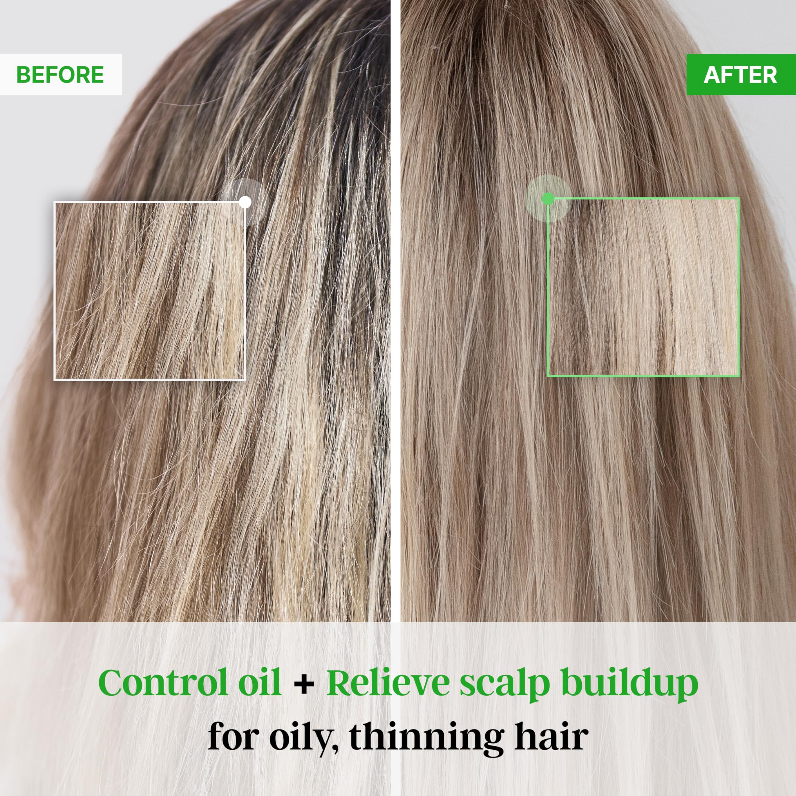 TS SHAMPOO Plus Biotin label closeup highlighting premium ingredients