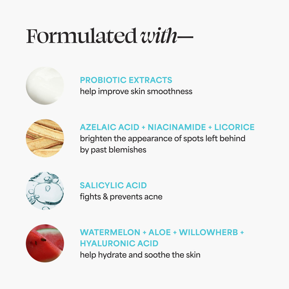 TULA Breakout Star moisturizer jar for lightweight acne hydration.