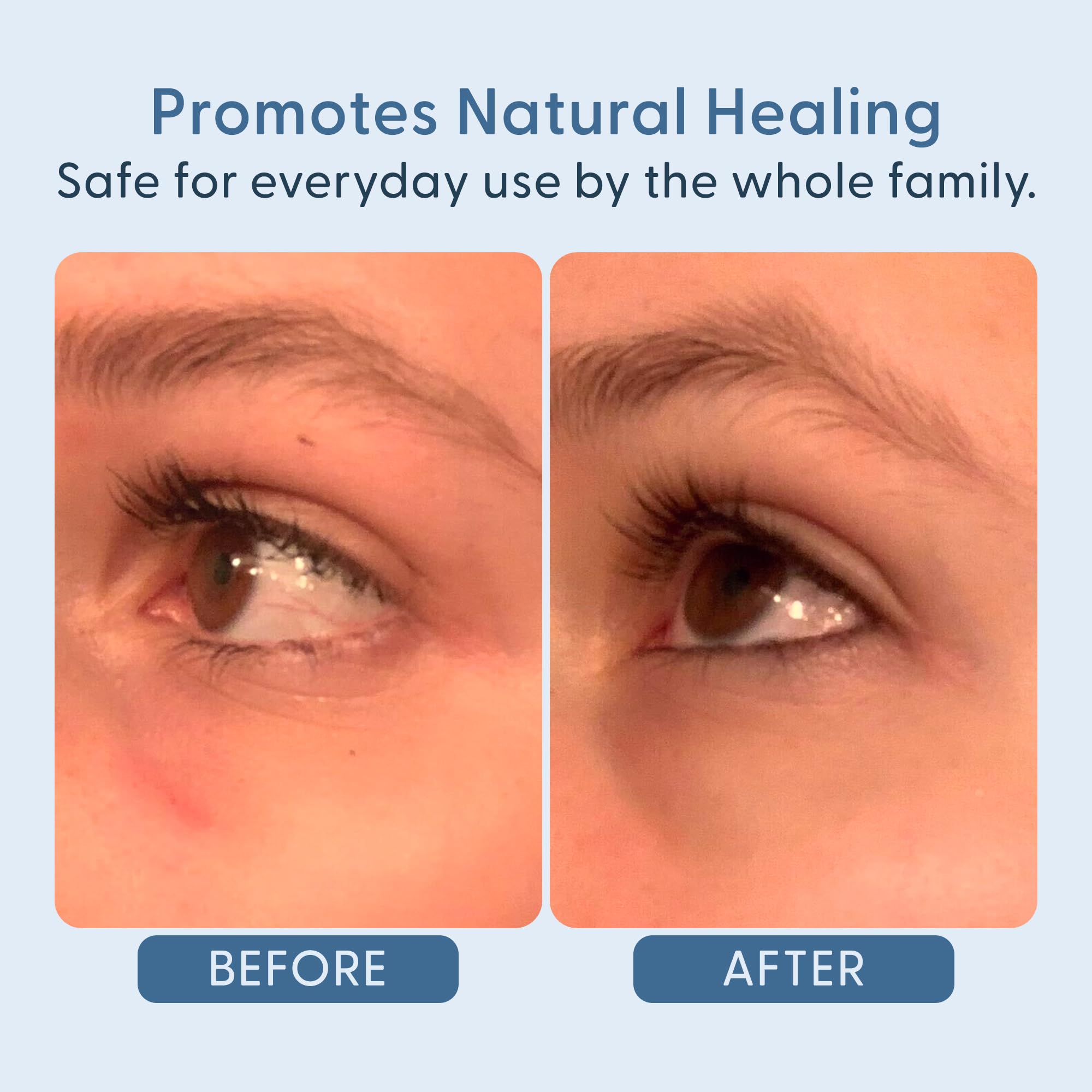 Twenty/Twenty Easy On The Eyes lashes cleansing close-up demonstrates debris removal.