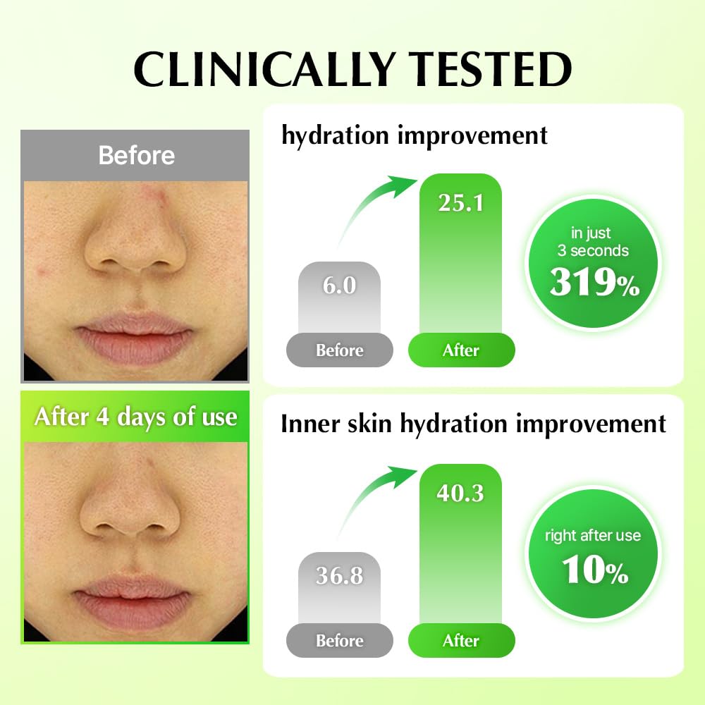 Application on hand demonstrates quick, gentle moisture without shine from UIQ cream.
