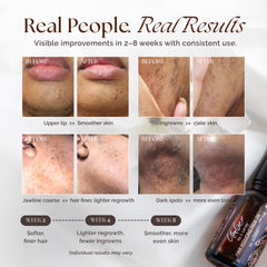 Umber By J. Lenay hair reduction spot fade oil demonstrates targeted treatment for problem areas