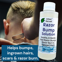 Cotton ball applying Urban ReLeaf Razor Bump Solution to irritated areas