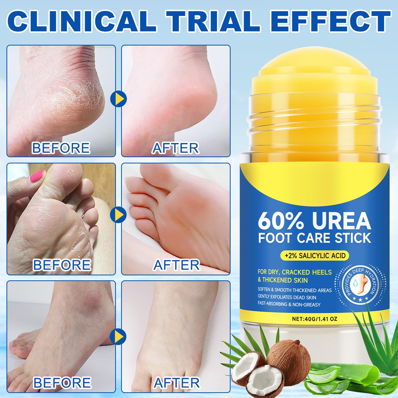 Travel-friendly 60% Urea Foot Care Stick for on-the-go foot care.
