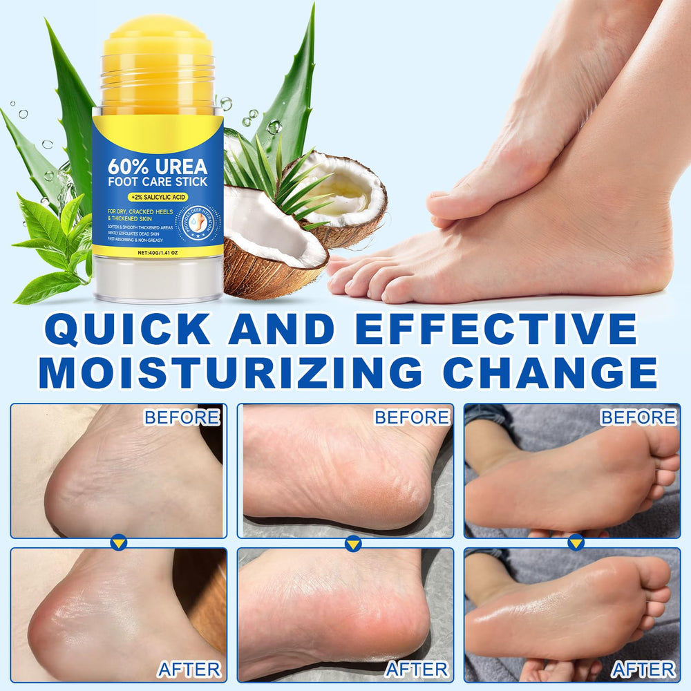 Packaging layout highlights Urea 60% & Salicylic Acid 2% Moisturizing Stick Balm for routine care.