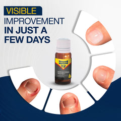 URIEL two silicone toe caps fit all sizes for versatile at home care.