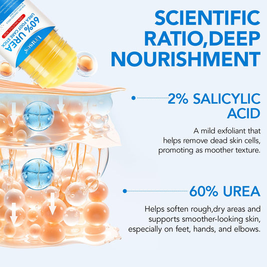 Uruses exfoliating cream with salicylic acid close-up reveals fresh skin.