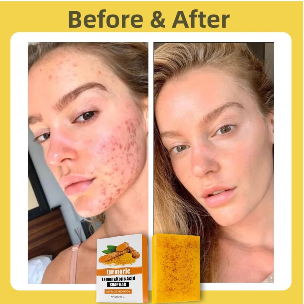 Uselective amino acids and shea butter boost hydration and barrier support.