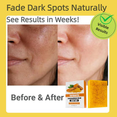 Uselective SLS-free cleansing is gentle on sensitive skin.