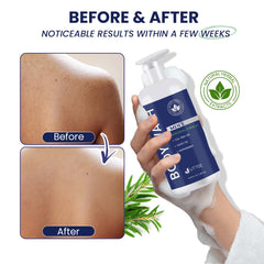Uttse Tea Tree Body Wash mint essence delivers cooling freshness.