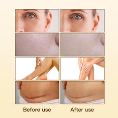UWPU Organic Rosehip Oil on cheek demonstrates even tone and gentle renewal.