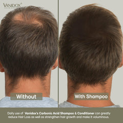 VANIDOX encourages thicker-appearing hair with hydrating cleansing.