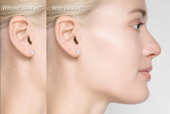 Vanish application process is quick and easy.