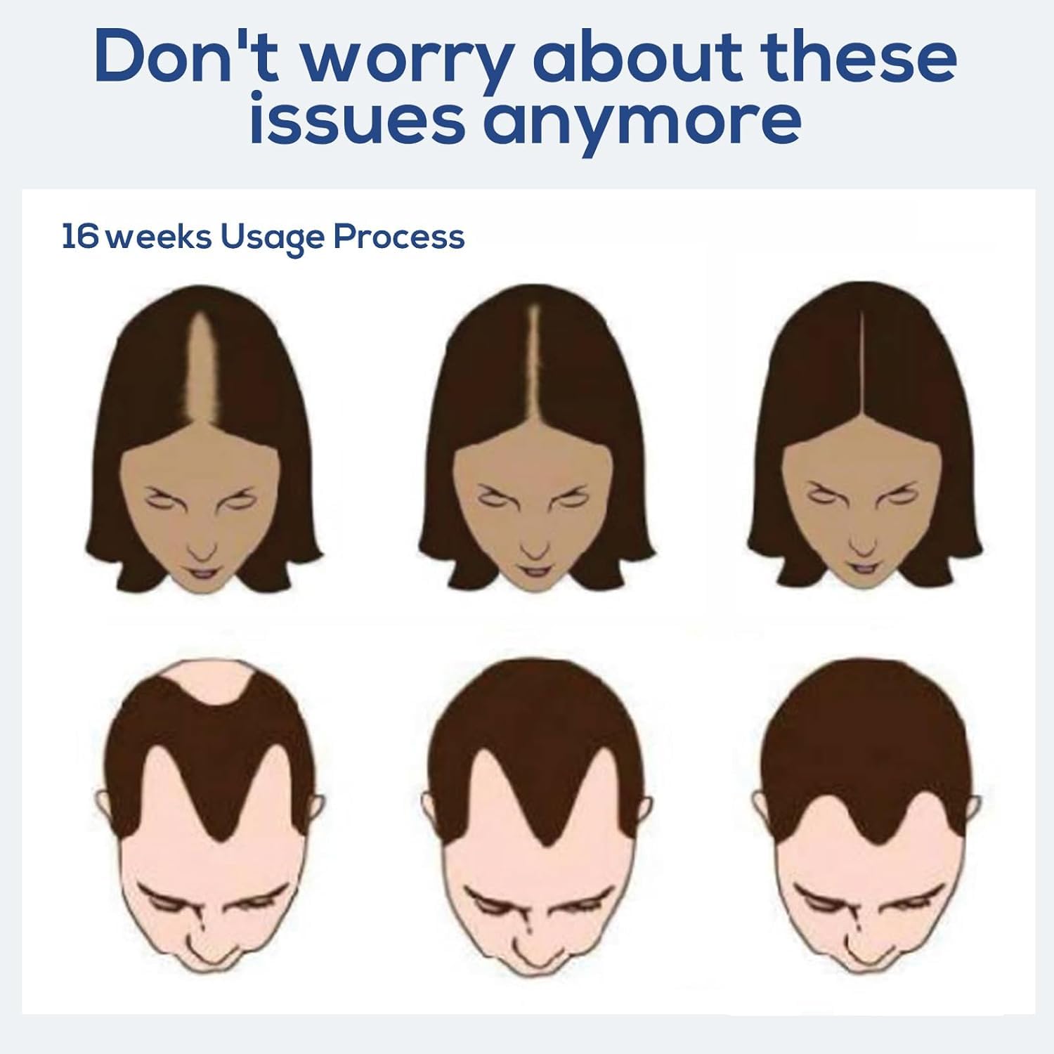 Vavis Lasercomb-001 during use demonstrating hair-parting action and scalp exposure