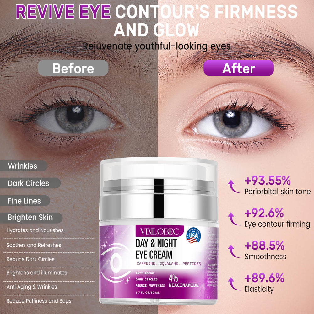 Applying Vbilobec eye cream under the eye for a refreshed look