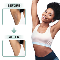 Bikini-area application with VCETree cream for uniform tone