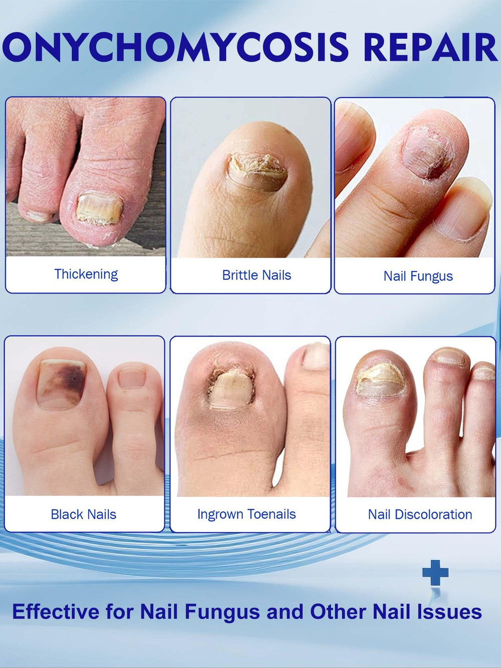 Vealvion hydrogel patch feels delicate and breathable on nails