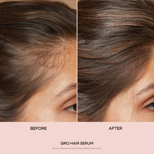 VEGAMOUR GRO Hair Serum being massaged onto the scalp for soothing care.
