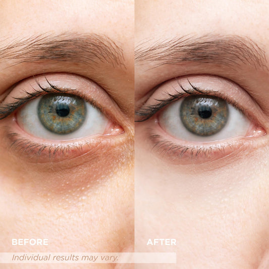 VELAMO ADVANCED SPF 41 under-eye cream jar shields delicate skin from sun exposure.