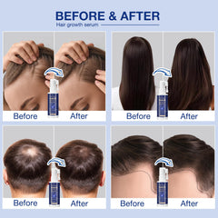 Venanoci Hair Growth Spray highlights rice water for strengthened hair health