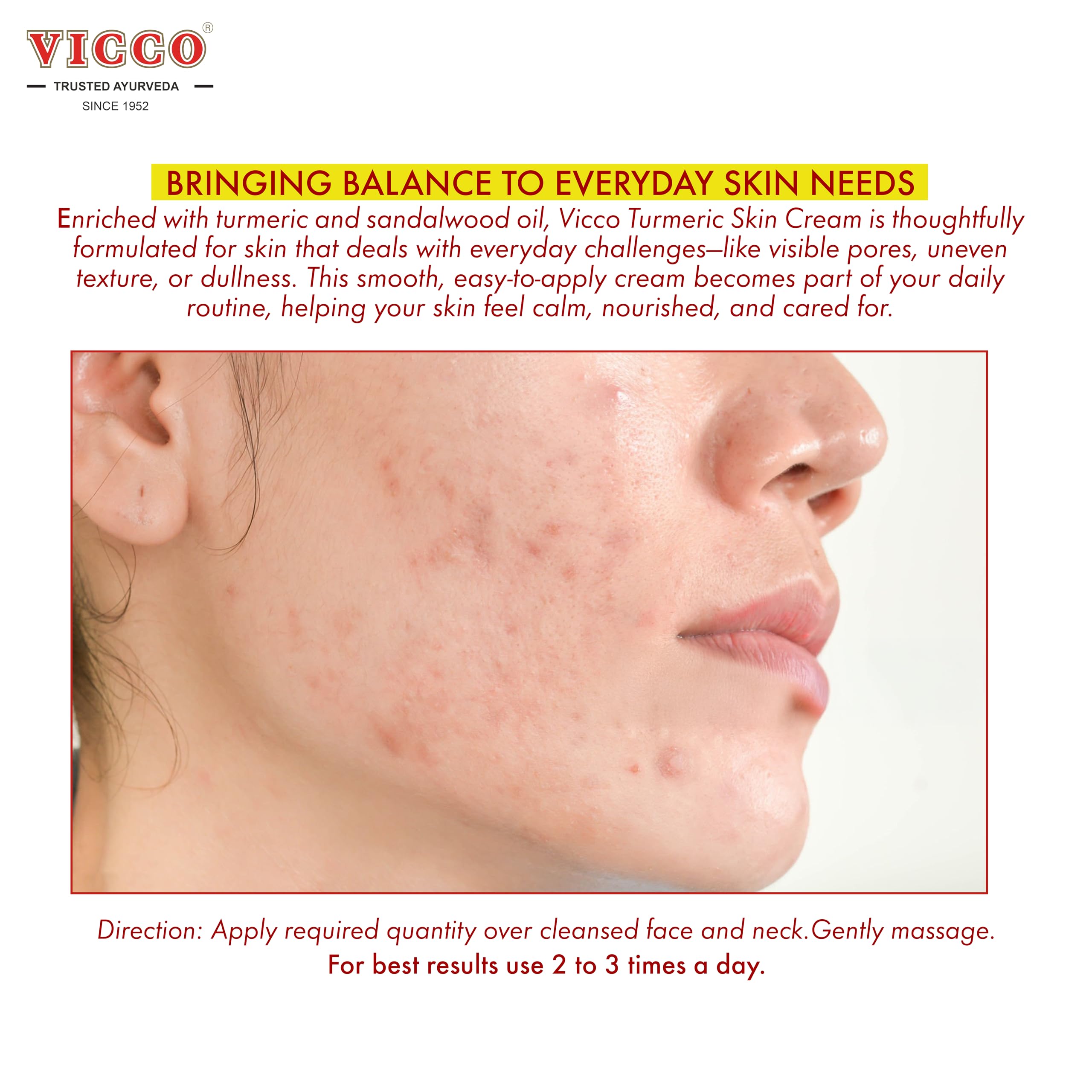 Vicco Turmeric Face Moisturizer Cream tube-application demonstrating quick absorption.