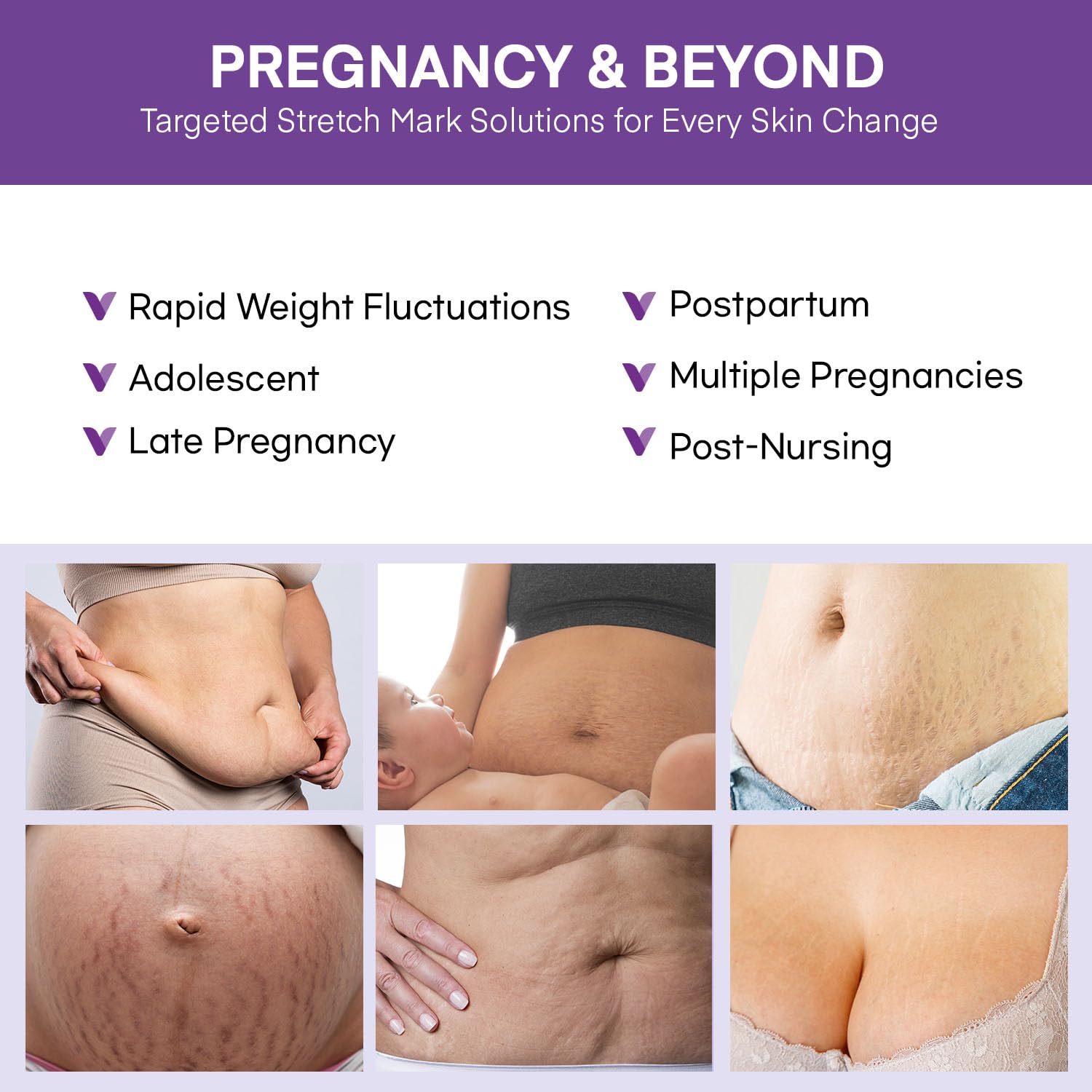 Vigority Stretch Mark Cream pregnant woman profile with glowing skin