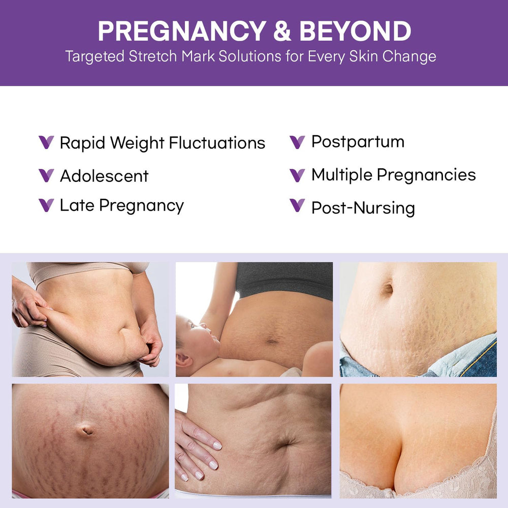 Vigority Stretch Mark Cream pregnant woman profile with glowing skin