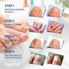 VigorWell Extra-strength formula for toenail maintenance