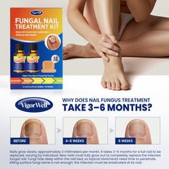 VigorWell hydrogel technology powering stronger, renew nails over time