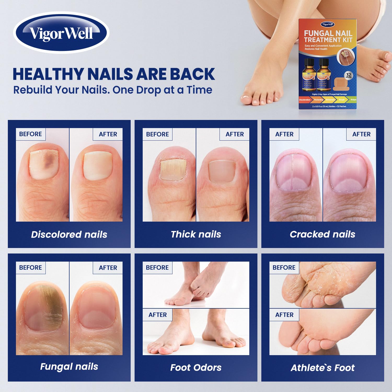 VigorWell toenail patch being applied during rest for targeted action