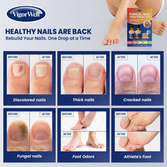 VigorWell toenail patch being applied during rest for targeted action