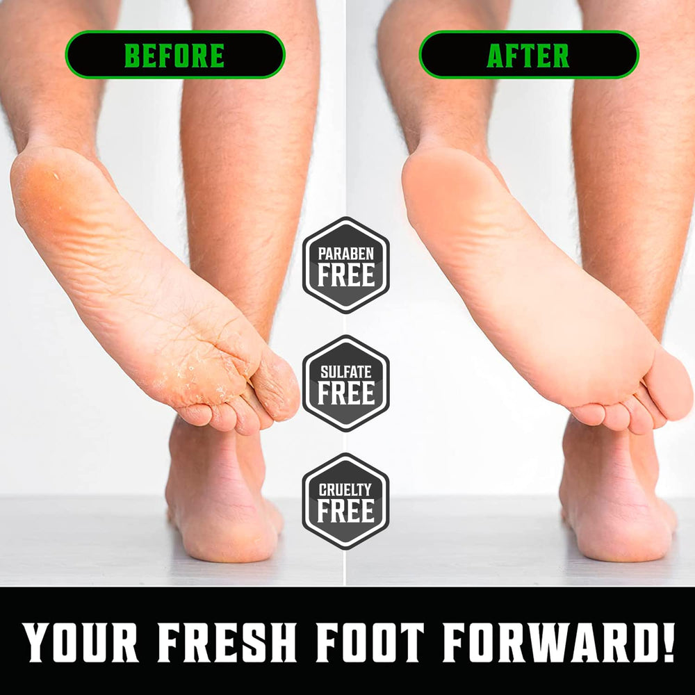 Applying Viking Revolution Tea Tree Foot Cream to cracked heels for moisture.