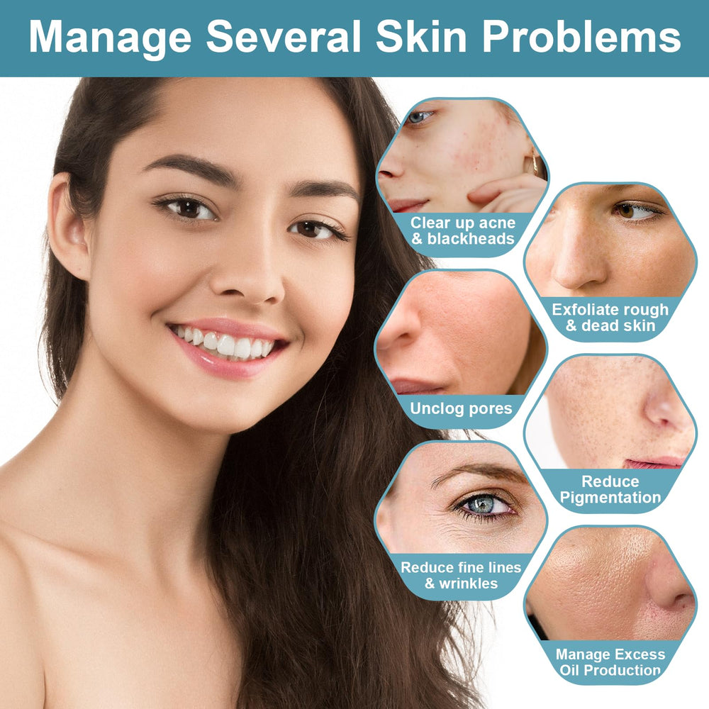 Viktairy salicylic acid powder heated to improve solubility in formulas