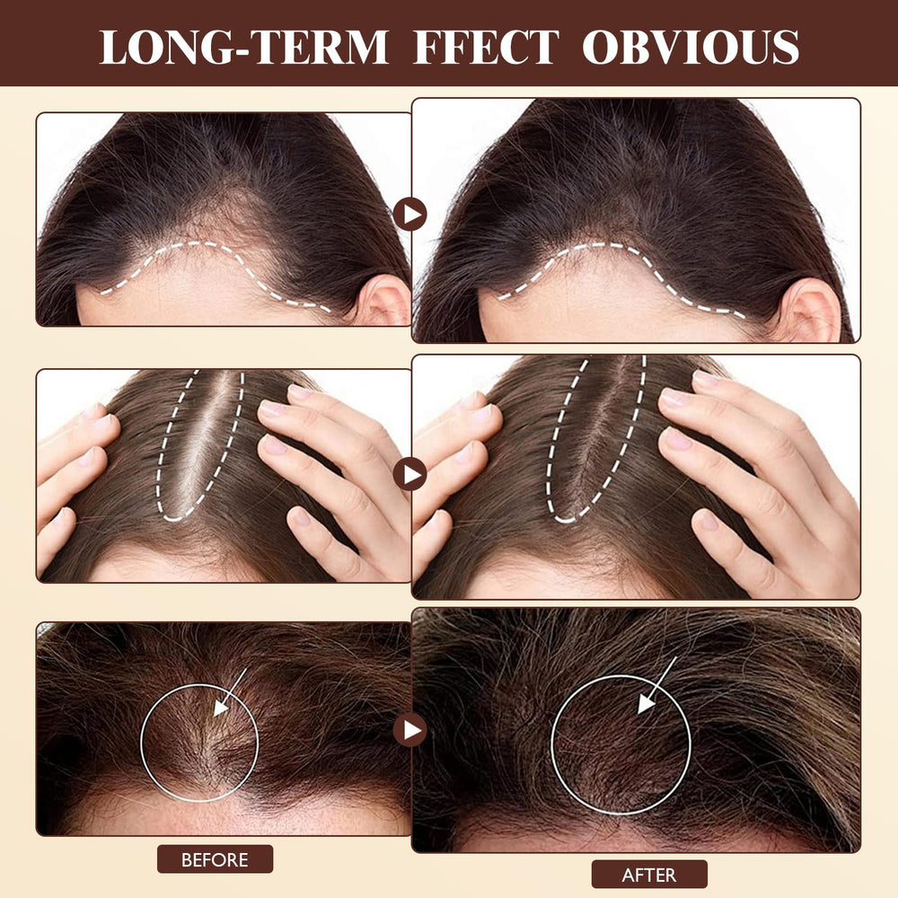 Vincofoo Hair Growth Spray promotes a shinier-looking hair after use
