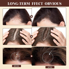 Vincofoo Hair Growth Spray promotes a shinier-looking hair after use