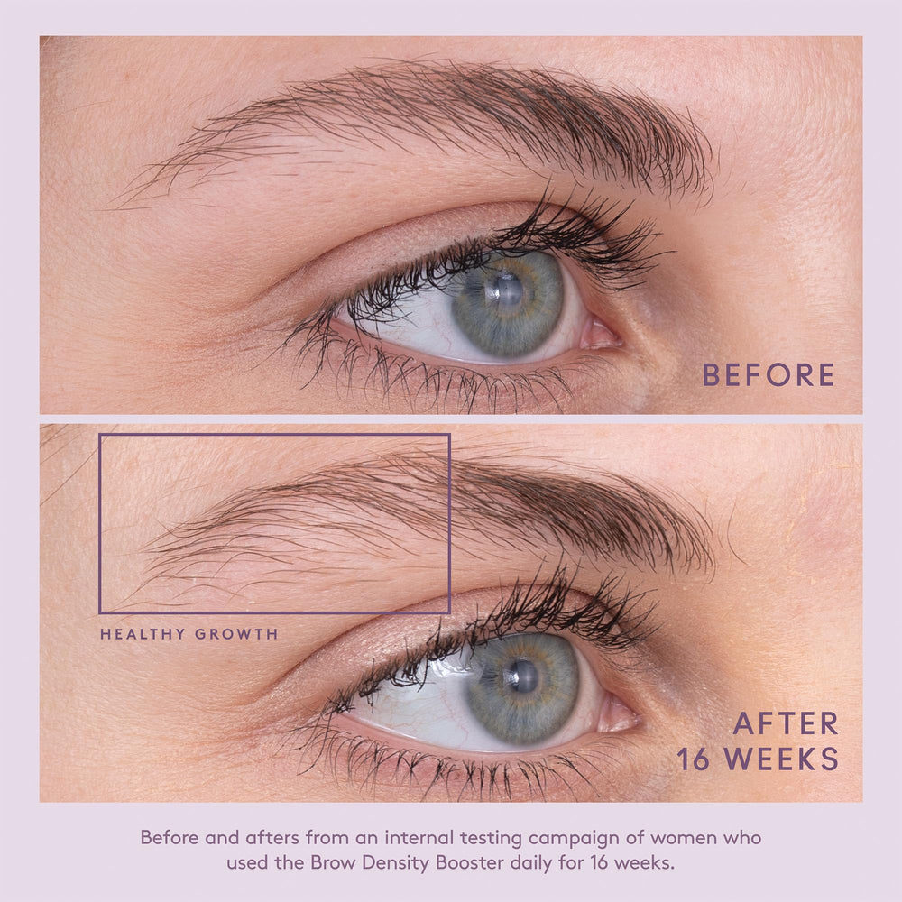 Illustration highlighting sparse brows and Virtue Flourish targeted care.