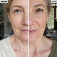 Hydrating VitailQ balm absorbs quickly for refreshed skin