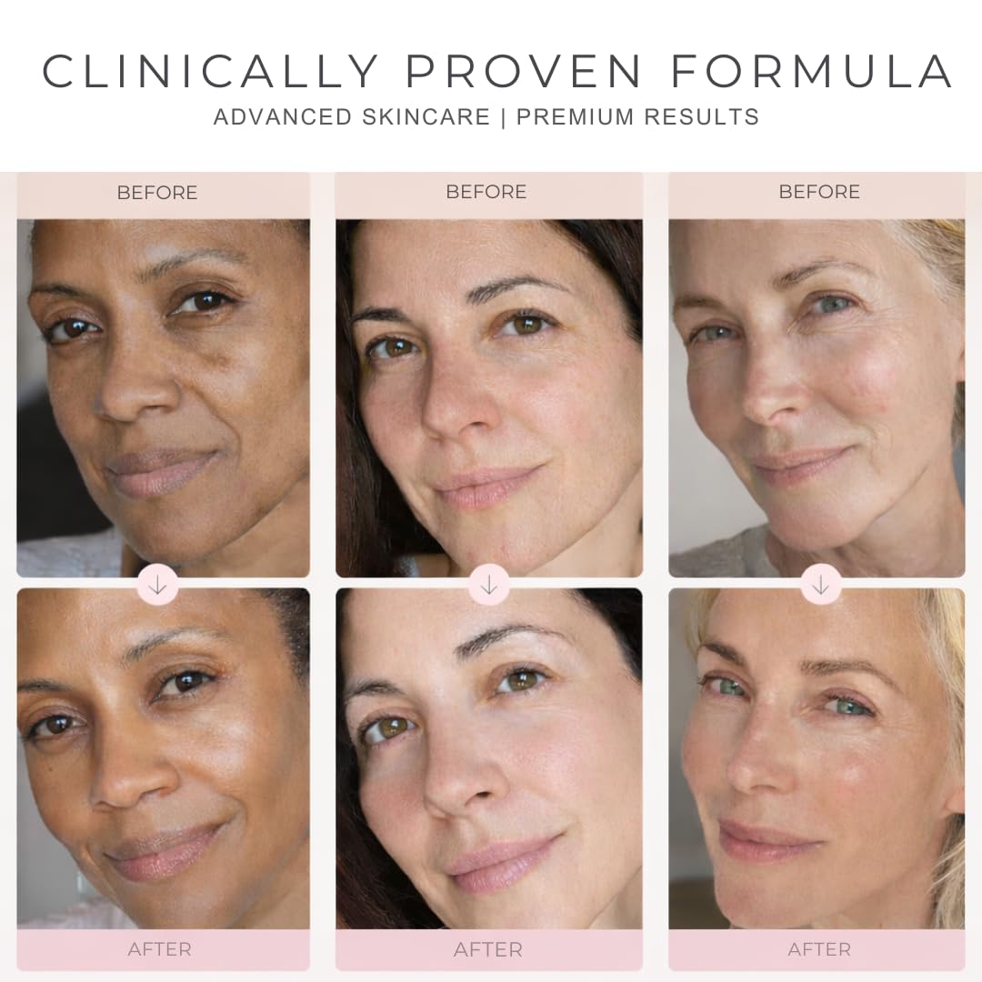 Vitalore retinol renewal effect for smoother complexion
