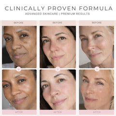 Vitalore retinol renewal effect for smoother complexion